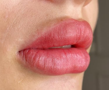 a woman with a LIP BLUSH micro labial