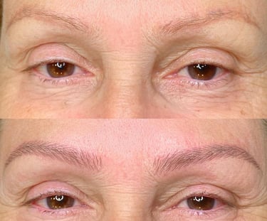 a woman with a NANOBLADING