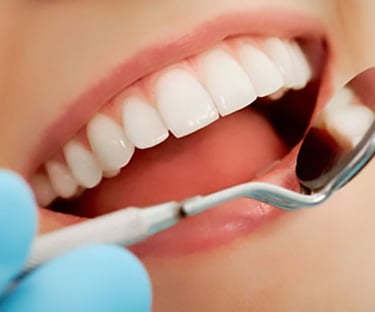 general dentistry in baner 