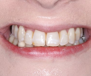 pictures of teeth