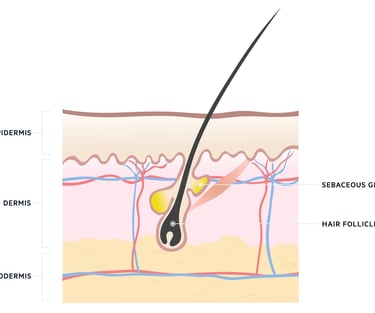 hair follicle singapore aesthetic clinic acne management