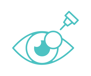 catarata retinopatía diabética pterigión