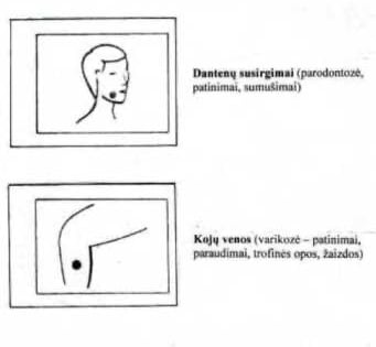 gydymo zonos