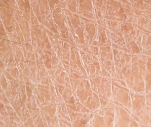 sheet mask for dry skin