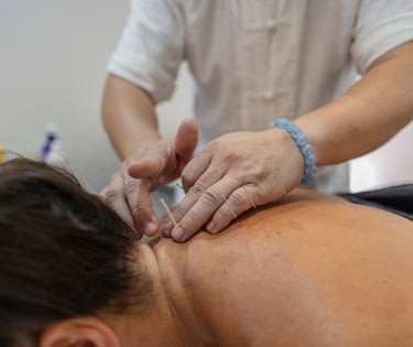 Acupuncturist applying needles to patient's neck