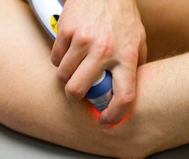 cold laser therapy on elbow