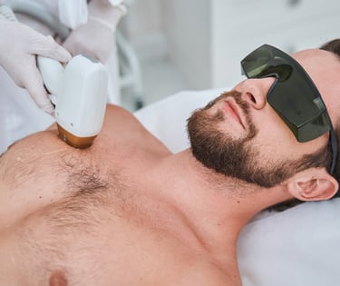 man getting laser hair removal on chest