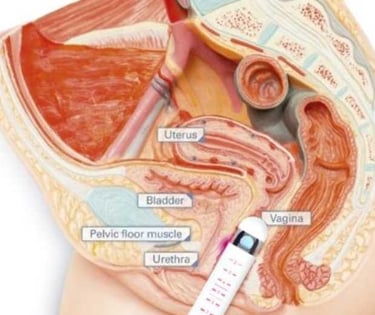 фото Схема використання Juliet