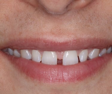 pictures of teeth