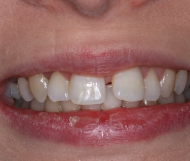 pictures of teeth