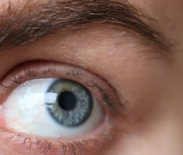 Plus de clis après un lashlift trop tôt, oeil bleu vert avec peu de cils