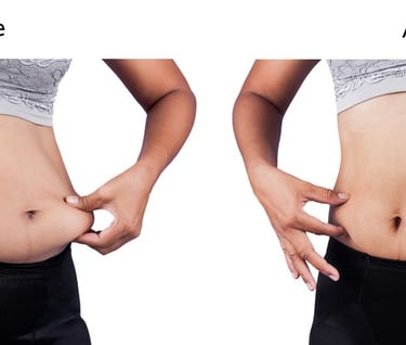 a woman's butt showing before and after her belly lift