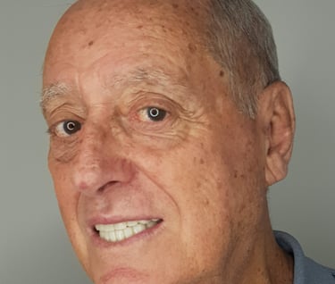 Sorriso rejuvenescido de paciente idoso tratado com resinas estéticas , Tatuape dentista