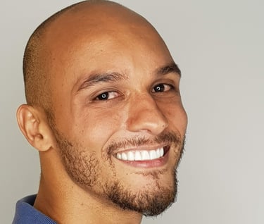 Paciente após tratamento completo de resinas estéticas com o método Resinalign na Sannre Odontologia