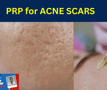 WATCH VIDEO : WATCH THE PROCEDURE BEING DONE click here now : https://youtu.be/_oEMEnPGVoo