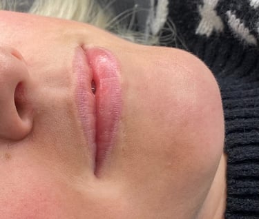 before lipblush