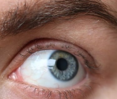 lashes damaged by lashlift