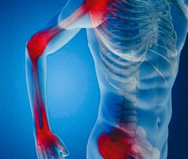 arthritis