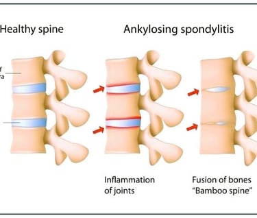 a diagram of a healthy spiner spiner