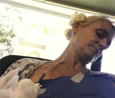 Celebrating Heart Port Removal