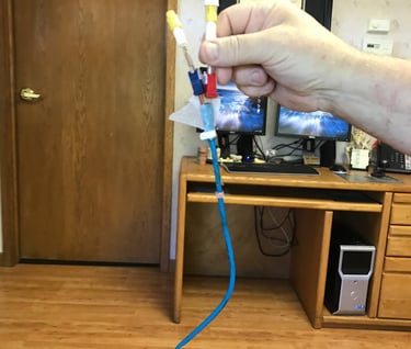 Removal of my Heart Port