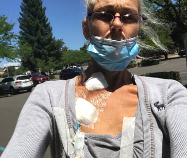 Prepping for my first dialysis