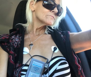 Heart Monitor after SCD