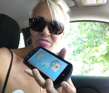 Heart Monitor in Burney California