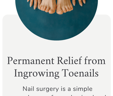 Permanent Relief From Ingrowing Toenails