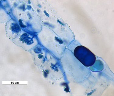 arbuscular m