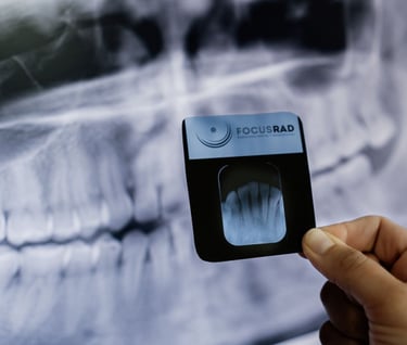 Evaluación de Radiografía