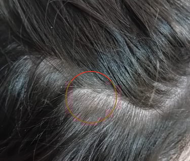 image de la même zone de sécheresse après l'application de l'argile.