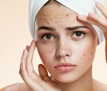 a woman getting a acne injection