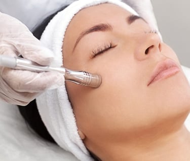 a woman getting a microdermabrasion
