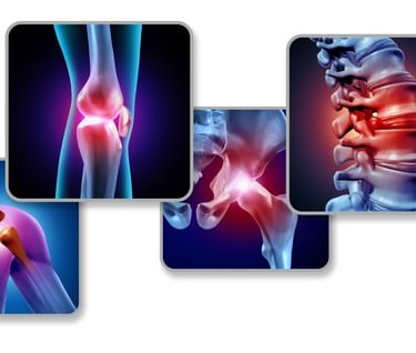 imagenes de artritis en centro de medicina alternativa novocen
