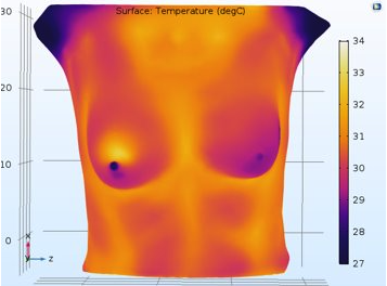Medical Thermography, breast cancer, thyroid cancer diabetes