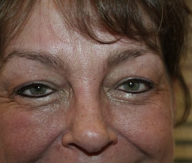 Client with permanent Eyeliner