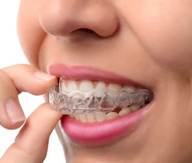 Clear Aligners