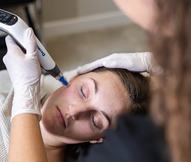 a woman is getting a microneedling treatment at a salon