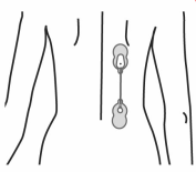 Diagram of Painmaster patches located on the side of the back.