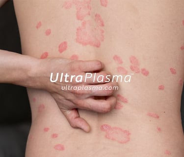 _ultra_plasma_ultra_plazma_ultra-plasma_ultra-plazma