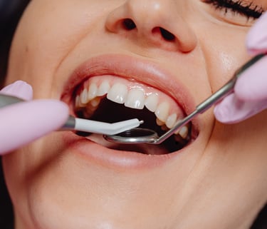 Dentist carefully extracting a damaged tooth using dental instruments in a clinical setting