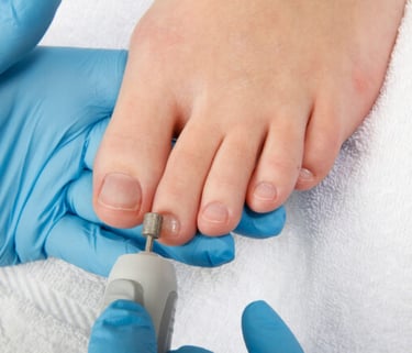 #FußpflegeOverath #Pediküre #GepflegteFüße  #SchöneFüße 