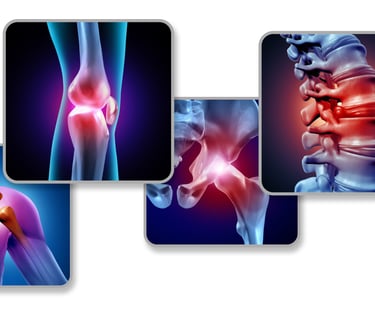 imagenes de artritis en centro de medicina alternativa novocen