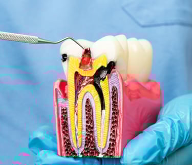 زراعة الأسنان - عيادة طب الاسنان دكتور وسام علي العباسي