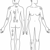 Site examples for Painmaster patches.