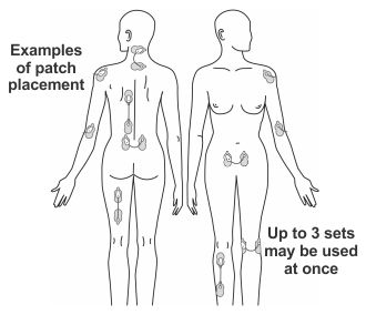 Diagram of a human body with Painmaster patch location sites.