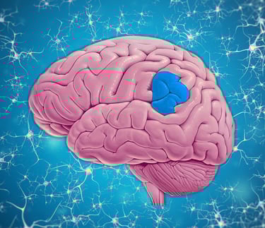 Brain in pink, highlighting the right supramarginal gyrus.