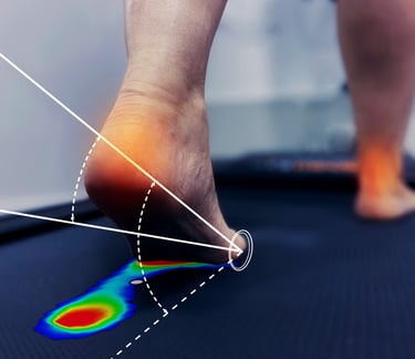 estudio biomecanico de la pisada plantillas