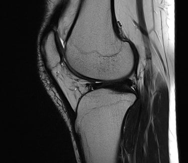 Knee MRI